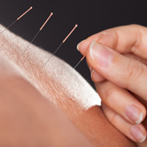 Acupuncture